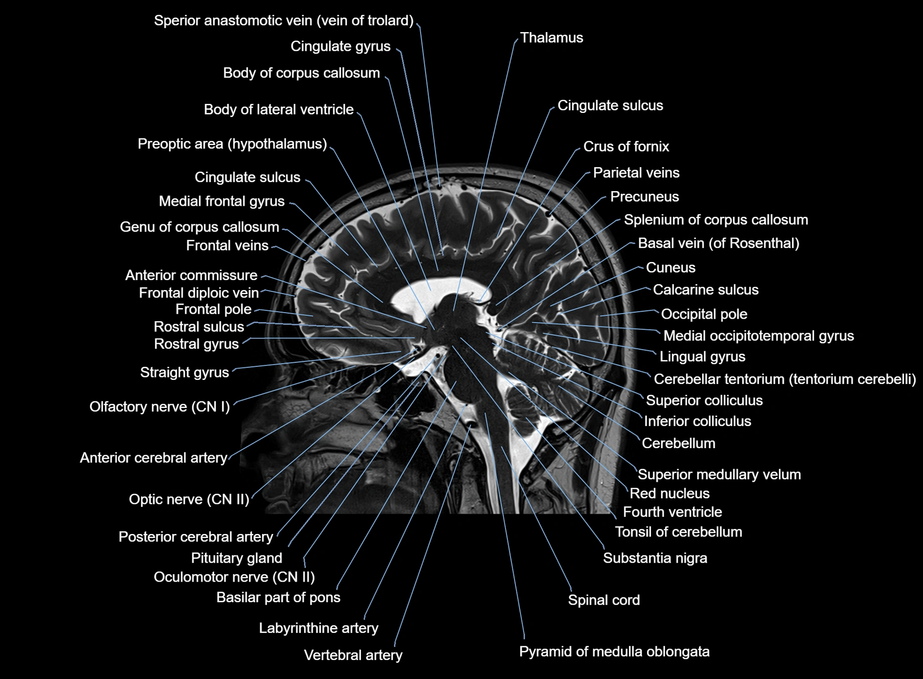 brain sagittal anatomy 3T MRI images -img-00001-00037.webp